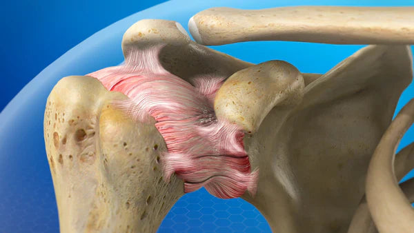 deltacore-pain3 Image