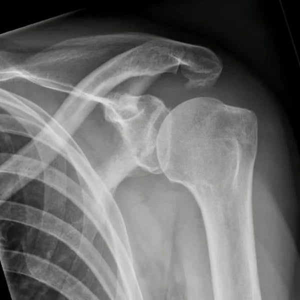 deltacore-pain4 Image