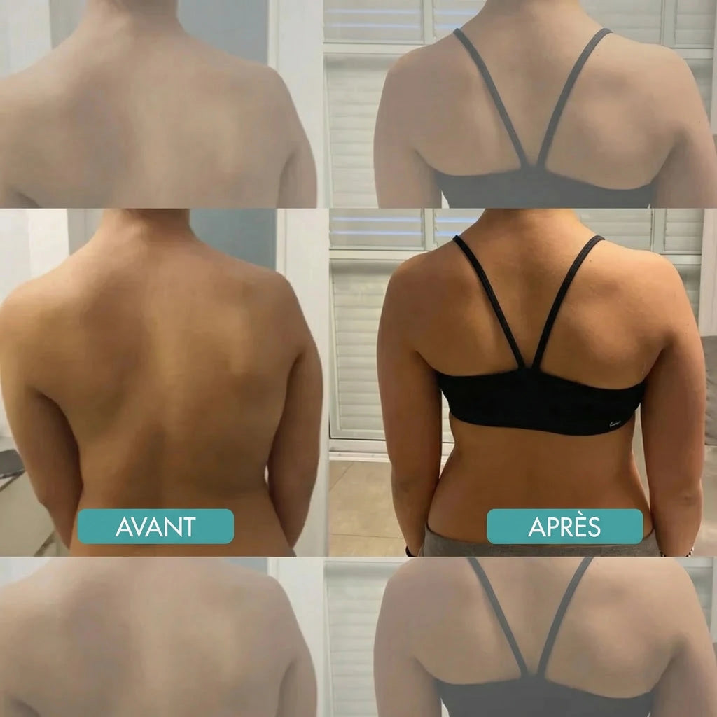 BackAlign | Correcteur de posture instantané