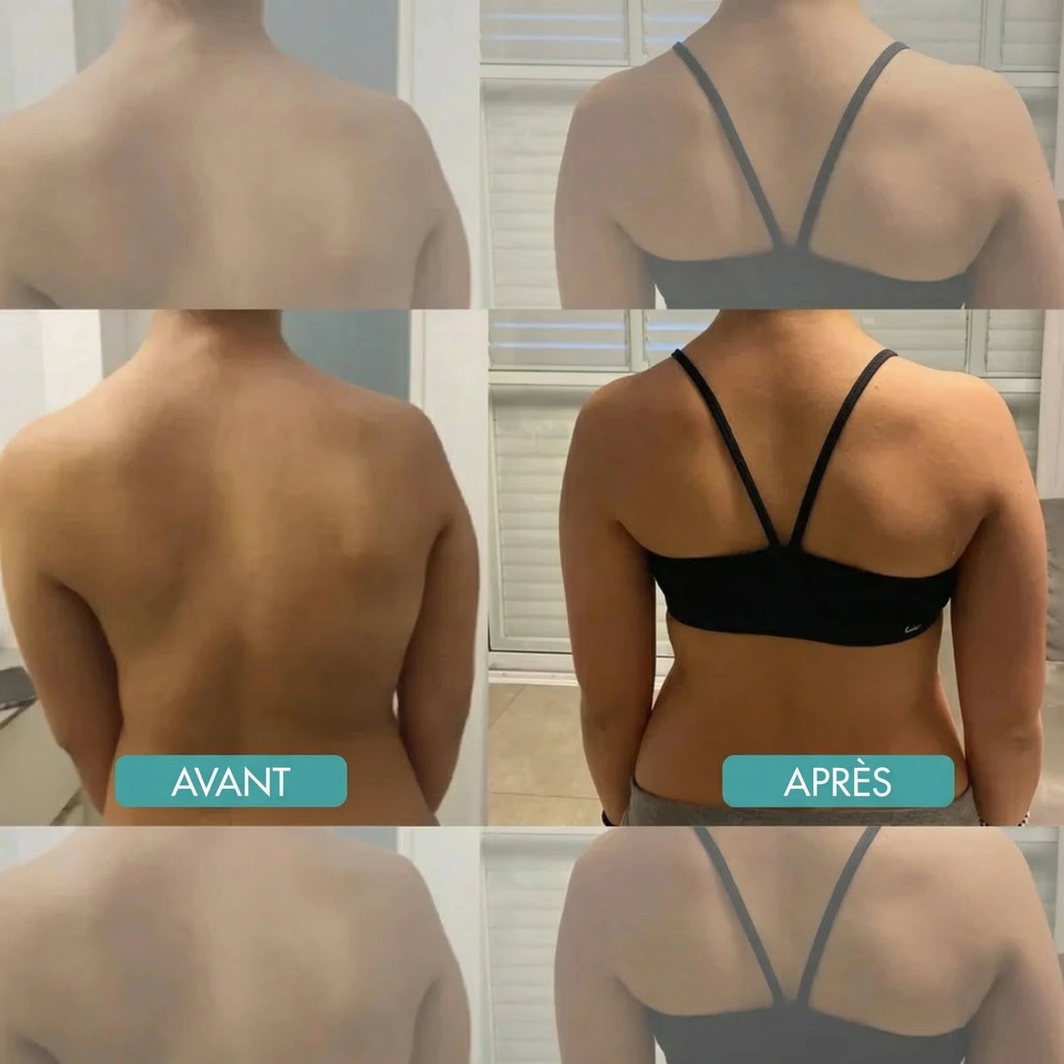 BackAlign | Correcteur de posture instantané