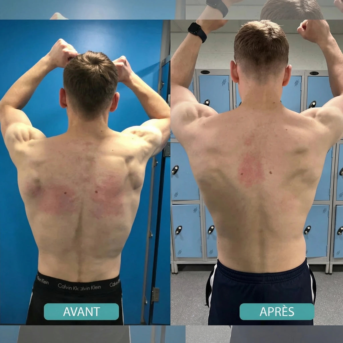 BackAlign | Correcteur de posture instantané