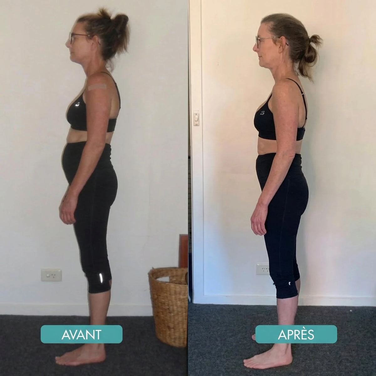 BackAlign | Correcteur de posture instantané