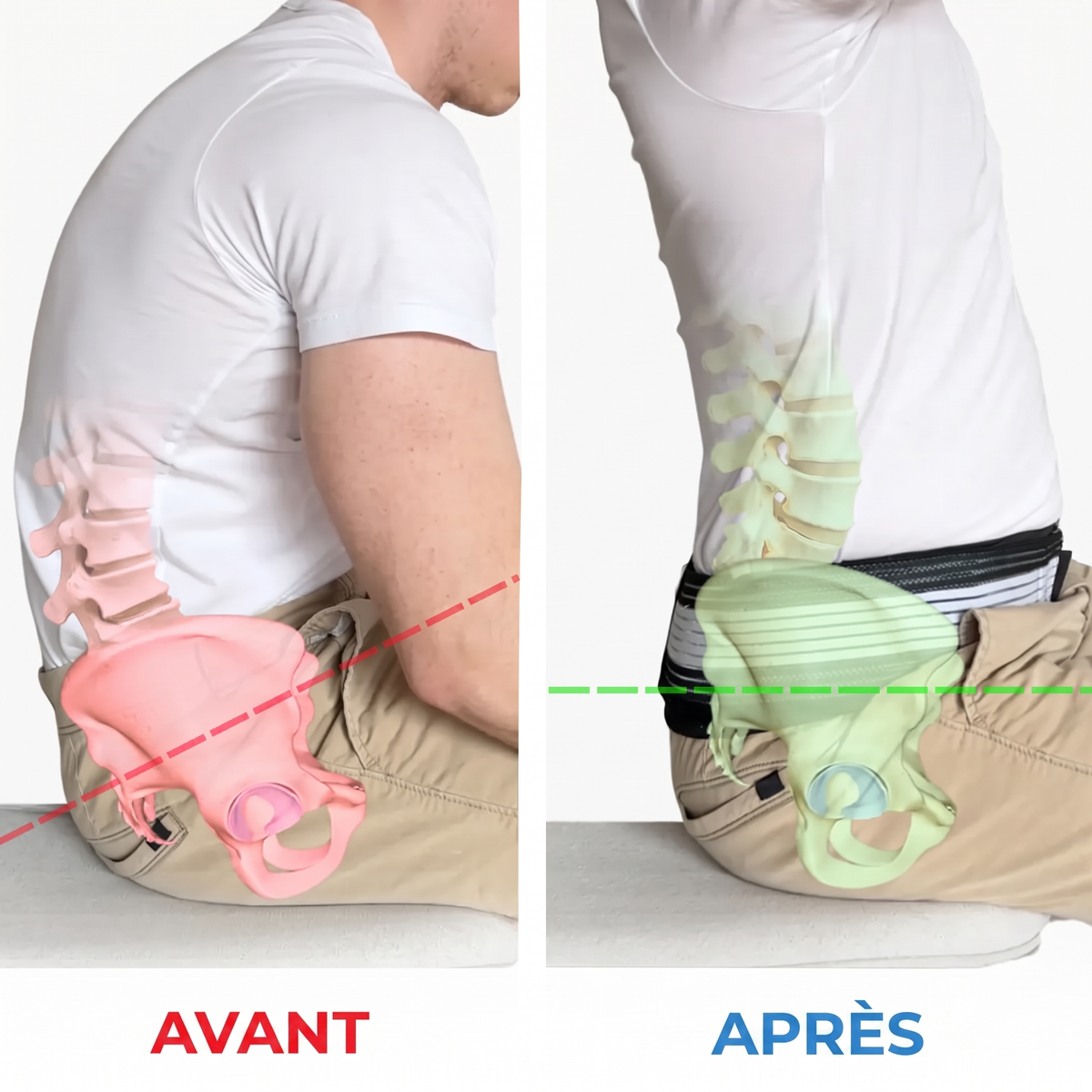 Posture avant après LombaCore