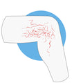 Thrombose